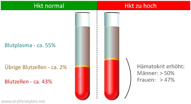 Blutwert Hämatokrit (Hkt) zu hoch / erhöht