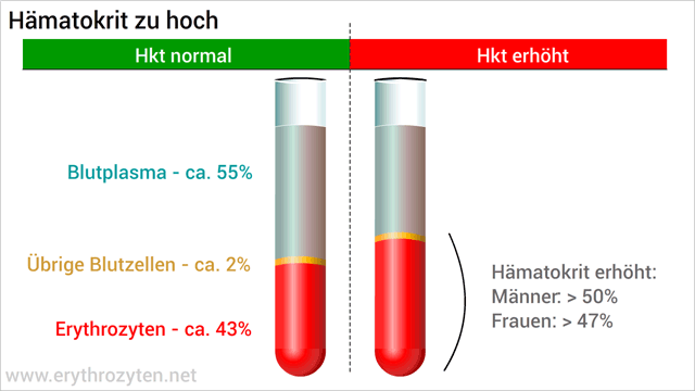 Hämatokrit zu hoch: Hoher Anteil von Blutzellen